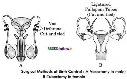 RBSE Class 12 Biology Important Questions Chapter 4 Reproductive Health 1