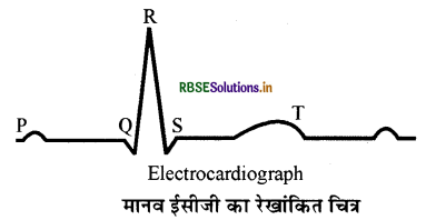 RBSE Solutions for Class 11 Biology Chapter 18 शरीर द्रव तथा परिसंचरण 3