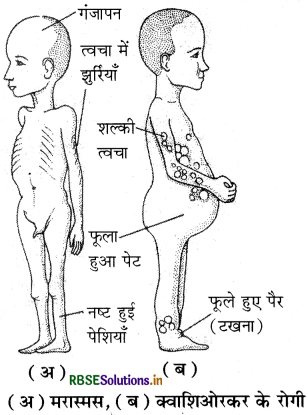 RBSE Class 11 Biology Important Questions Chapter 16 पाचन एवं अवशोषण 32