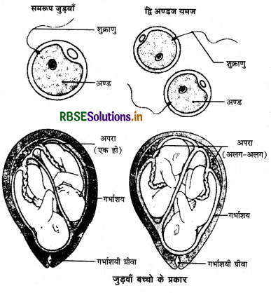 RBSE Solutions for Class 12 Biology Chapter 3 मानव जनन 11