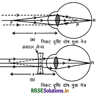 RBSE Class 12 Physics Important Questions Chapter 9 किरण प्रकाशिकी एवं प्रकाशिक यंत्र 16
